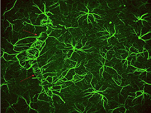 Photo of 'helper cells'